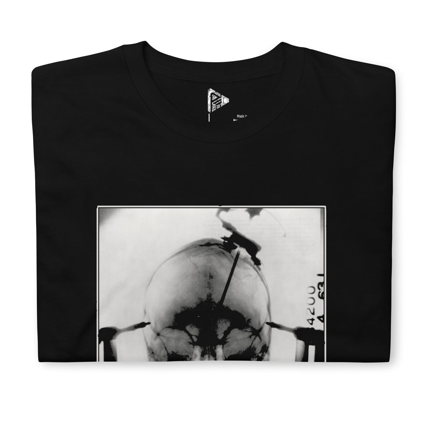 X-Ray T-Shirt